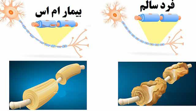 ۵ راه خانگی برای کم کردن درد