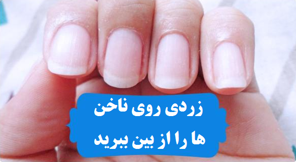 ۷ ترفند برای زیبا شدن